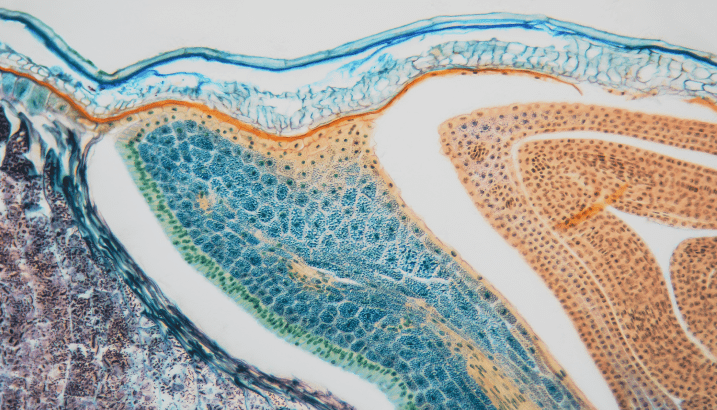 Featured article image